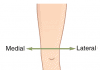 Lateralno